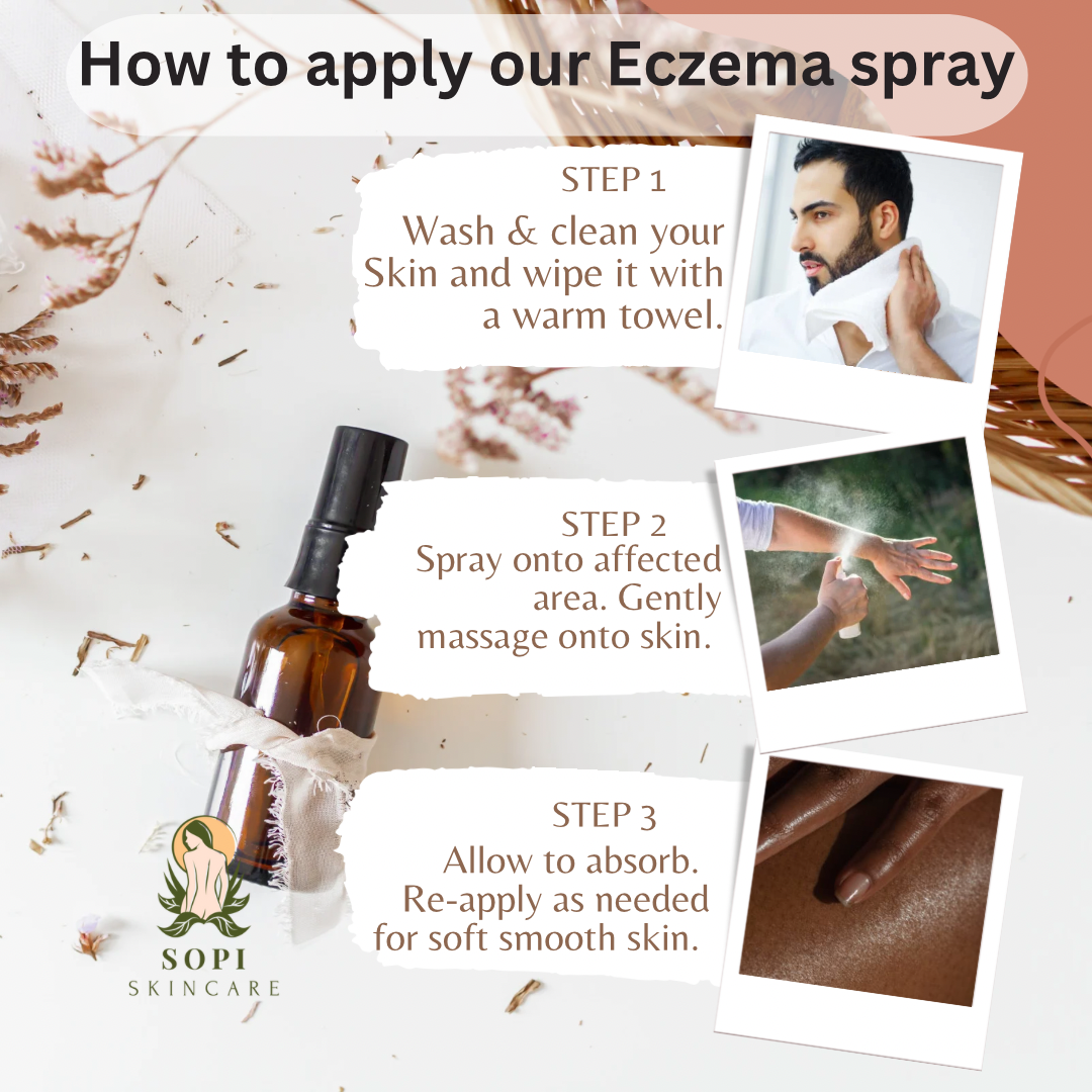 Ezcema Relief Skin Spray