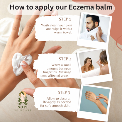 Eczema Relief Set